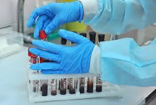 Sfax : 3 nouveaux cas de contamination horizontale confirmés