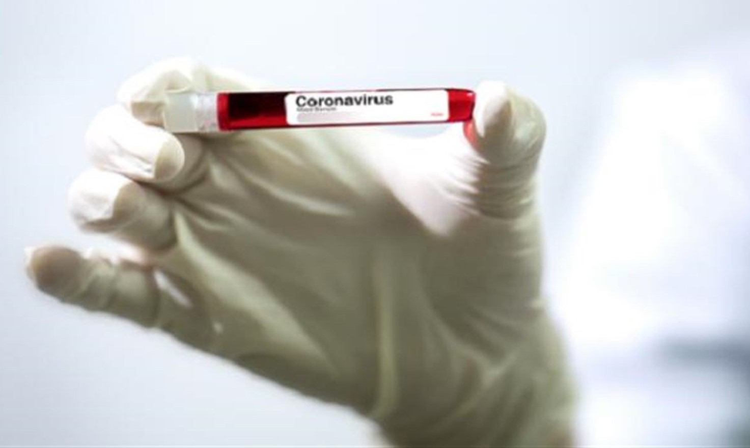 وكالة “أنسا” الإيطالية: الدواء جاهز للقضاء على فيروس كورونا