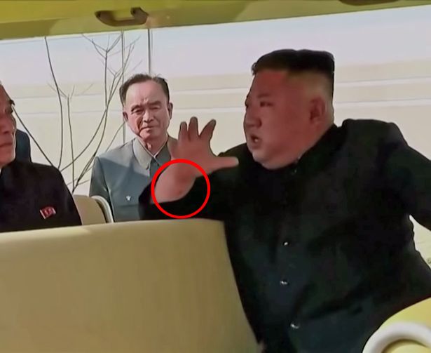 علامة غامضة على يد زعيم كوريا الشمالية تحيّر الإعلام الغربي