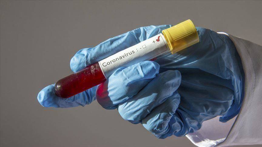 بنعروس/تسجيل 46 إصابة جديدة بفيروس كورونا خلال هذه المدة