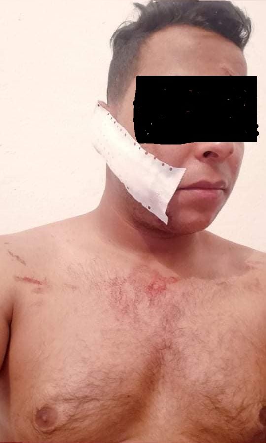 القيروان: تعرض عون للحرس الوطني إلى اعتداء
