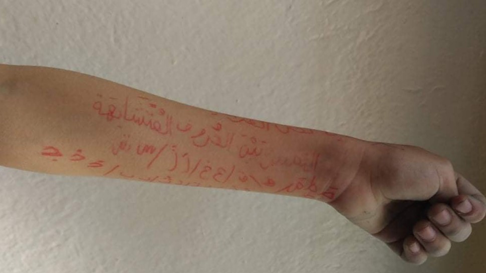 المعلمة المتهمة بنسخ نص على ذراع تلميذ تكشف “حقيقة” ما حصل
