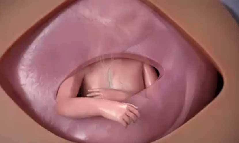 على يد طبيب عربي/ عملية جراحية لجنين داخل بطن أمه (فيديو)