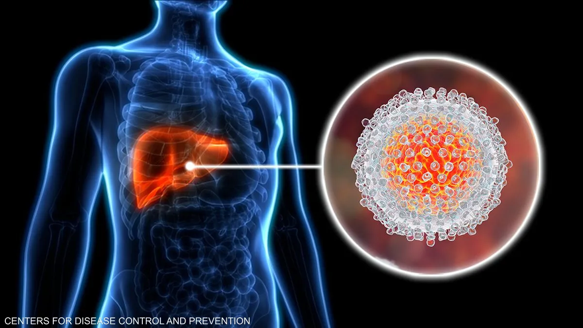 5 علامات تحذيرية قد تدل على “مشكل خطير” في الكبد